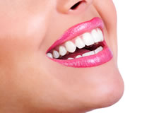 Veneers in Dearborn Heights MI with Dr. Vertin